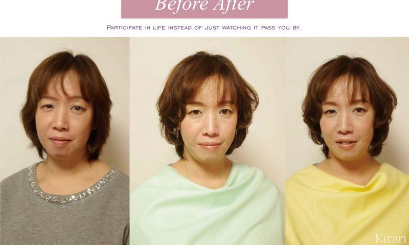 before-after